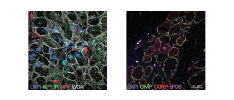 Porcine ventricular myocardium and dorsal root ganglion stained for various peptides and receptors. More info in accordion.