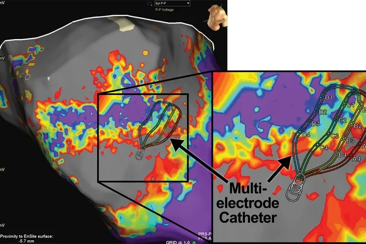 A screen capture shows the electrical activity of the heart. More in caption.